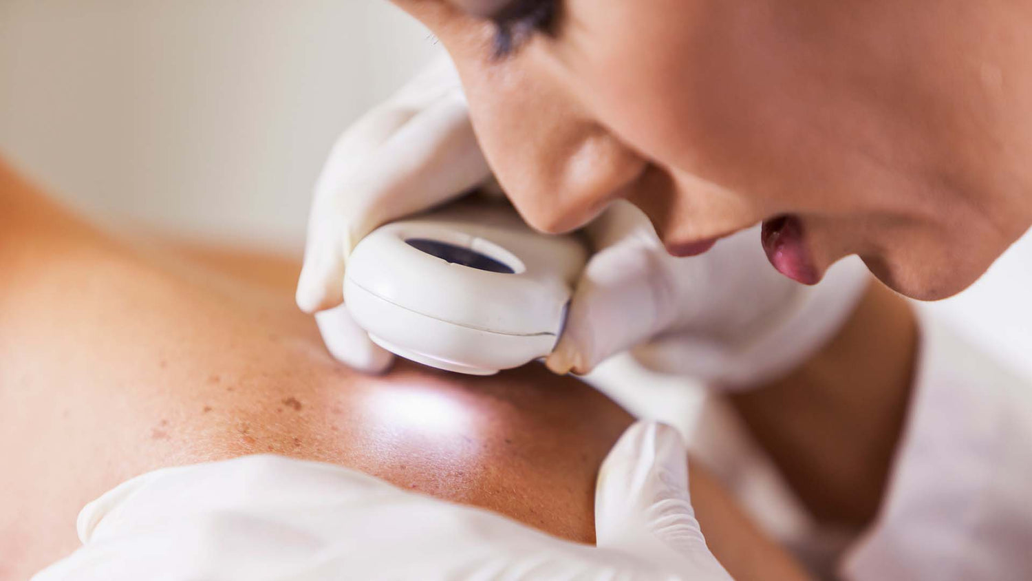 Annual Dermatology body scans are extremally important in detecting skin disease and cancer